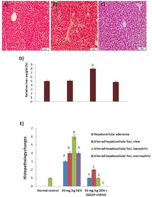 Inhibition of induced-hepatic cancer in vivo through IQGAP1-shRNA gene therapy and modulation of TRAIL-induced apoptosis pathway